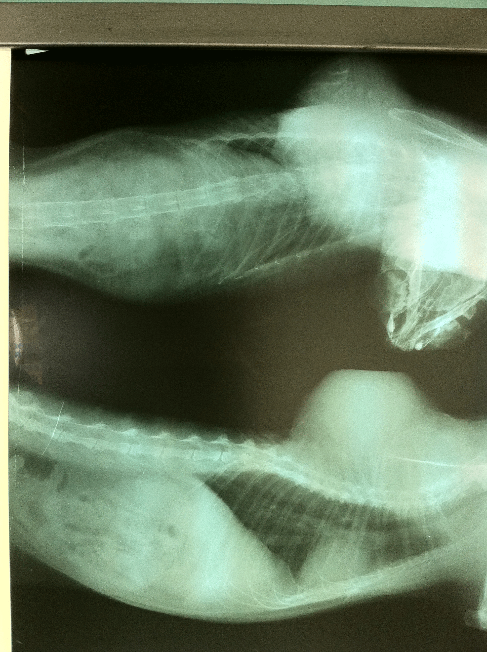 fibrosarcoma